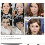성형 뺨치는 신<b>기술</b>