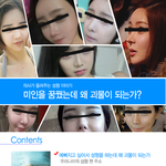 [성형<b>미용</b>] [의사가 들려주는 성형이야기] 미인을 꿈꿨는데 왜 괴물이...