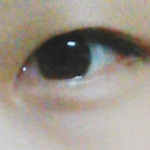 저<b>수술</b>해야될까요?