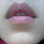 <b>윗입술</b> 가운데<b>부분</b>!