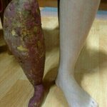 [블락비] <b>왼쪽</b>내다리