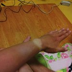 [활화산] 아버지의 식중독이 나에게 준 선물