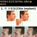 한국과는 다른 미국의 성형수술. <b>best</b>3