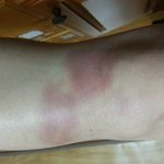 [EXO] 으르렁 <b>무릎</b>춤있자나