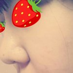 [조언부탁] 코수술 해야할지 고민이에요