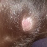 [고양이] 고양이 <b>피부병</b>인가요.....??....