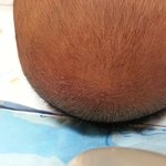 애기 머리 각질 <b>대체</b> 왜이럴까요
