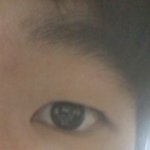 [댓글부탁] <b>눈</b> <b>성형</b>해야할까요?