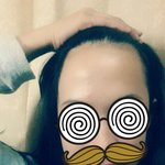 [조언부탁] 이마평가좀해주세요ㅠㅠ