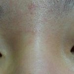 [조언부탁] [<b>혐오주</b>의] 피부가 저보다 안 좋으신 분 있나요?