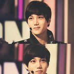 [EXO] 김종인 코<b>수술</b>하기만해봐ㅡㅡ