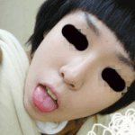 지긋지긋한 여드름 탈출기!