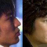 [댓글부탁] 남자 연예인들도 <b>성형</b>?????
