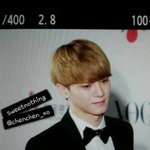 [exo] 종대 이 머리에
