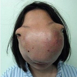 <b>의학지식</b>이 있으신분들에게