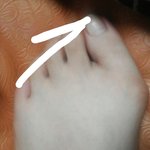 [조언부탁] [조언부탁]선천적인발모양장애 이게제잘못인가요