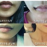 <엽기>  요즘 유행하는 성형수술