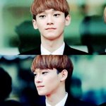 [CHEN] <b>아우</b>ㅠㅠ종대
