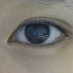 저<b>쌍수</b>했는데..어때요?ㅠㅠ