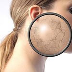 겨울철 재난에 빠진 피부를 구해줄 방법