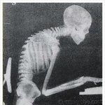 [더베네핏]  <b>평소</b> <b>자세</b>로 인해 허리가 아프신 분들!