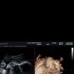 38+2일된 초<b>산모</b>인데용