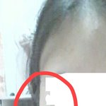 사진) <b>얼굴</b>형<b>때</b>매 스트레스받아요ㅠㅠ