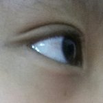 [댓글부탁] 다크<b>써클</b>이너무심해요