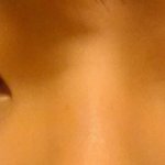 [댓글부탁] 쌍꺼풀 없는 눈인데 성형 할까요?