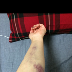 상쾌한병원에서 <b>채혈</b>하다 너무나 억울하고 황당한일.. 절대 가지마세요