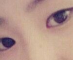<b>짝눈</b> 쌍수필요한가??