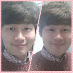 얼굴 고치고 살아야 하나요ㅠ
