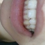 [댓글부탁] 제 <b>앞이빨</b>에 이거뭐예요??;;