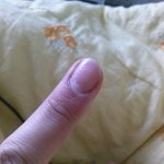 [댓글부탁] <b>손톱</b>에 줄이나잇는데ㅜㅜ
