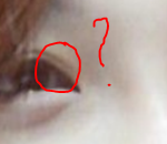 [exo] 정은지<b>쌍수</b>