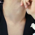 [비상대피소] 디오<b>키스</b>마크 