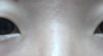 <b>쌍수</b> ㅠㅠㅠ