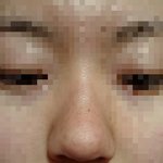 혐/제 코 어떡해야할까요?ㅠㅠ