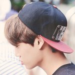 [카이] 부은 강아지짤 일년전 일년<b>후</b>