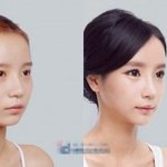[한아름송이] 사진有/한아름송이 <b>성형</b>했잖앜ㅋㅋㅋㅋㅋㅋㅋㅋㅋㅋㅋㅋㅋ