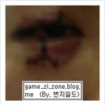 [도와주세요] 홍대 <b>노숙</b>자에게 눈 찢겼습니다!