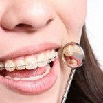 <b>이</b>천 여주 <b>지역</b>에서 유명한 치과