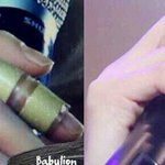 [EXO] 변백손<b>흉터</b>남....
