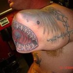 <b>상어</b>에 물려 팔 잘린 남자의 당당한 자가극복