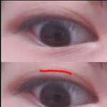 [조언부탁] 오른쪽만쌍커풀왼쪽은끈켜진쌍커푼