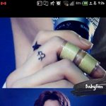 [백현] 예쁜손왜다쳣어!걱정되게ㅠ