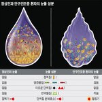 <b>안구</b>건조증 있으신가요?