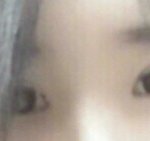 [EXO] 난 쌍수 앞트임 눈매교정 다 함