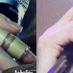 [EXO] 백현이 손에 흉터가 남은이유