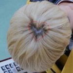 [세훈] 오세훈은 <b>정수리</b>로도 영업함